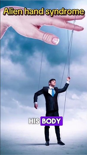 Alien Hand Syndrome: What Happens When Your Hand Has a Mind of Its Own. #short #facts #education