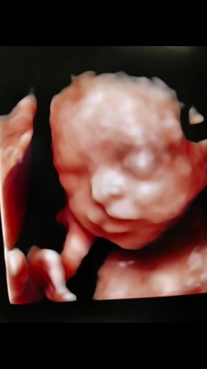 23 Weeks Pregnant Ultrasound Scan with Cleft Lip | Detailed 4D Imaging