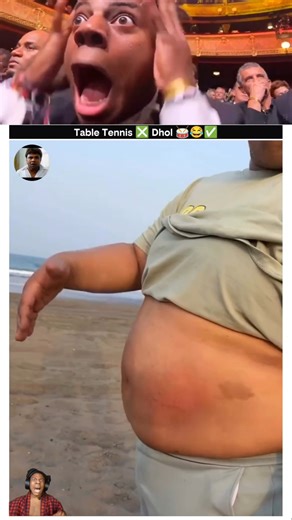 Introducing the "VitalWear SmartBand"— a next-generation wearable gadget 🎉.#shorts #funny