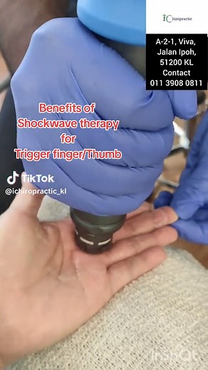 Understanding Shockwave Therapy for Trigger Finger and Thumb