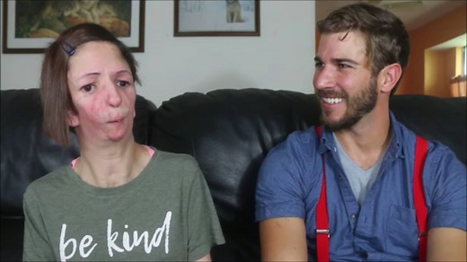 3.2M views · 66K reactions | Ashley is diagnosed with Nager syndrome. She hopes to one day start a family with a man who accepts her fully. Watch this full interview at youtu.be/bkuZZxYt588. | Special Books by Special Kids | Facebook