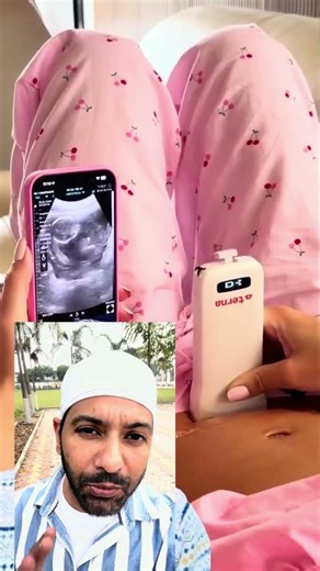 Homely ultra sound machine