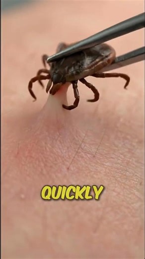 Never Rip a Tick Off Like This 😱 #shorts