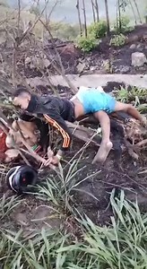 Bike Accident Aftermath