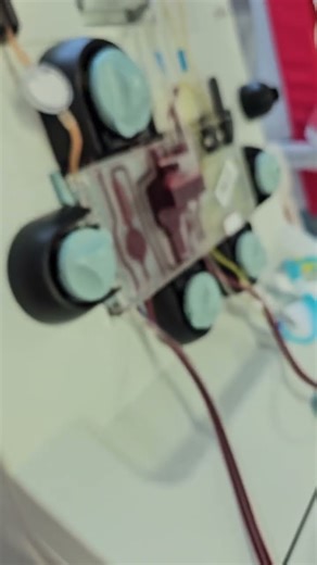 This Machine Separates Life-Saving Platelets 😮🩸