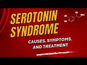 Serotonin Syndrome Causes, Symptoms, and Treatment