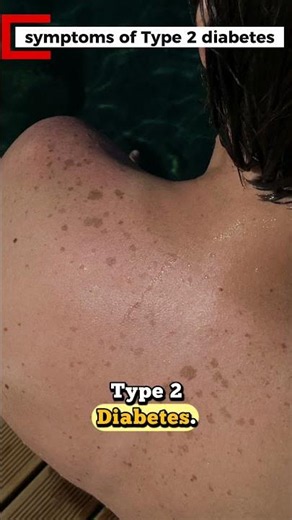 Dark Skin Patches? Here's What They Mean