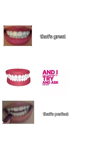 Understanding Crossbites and Their Impact