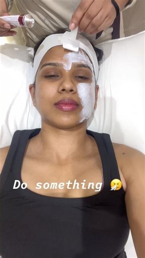 If You Have Acne, Watch This! 😱🤧 || No Filter, Just Truth ✨ #viral #mustwatch #musttry