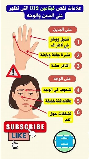 📌 علامات نقص فيتامين B12 التي تظهر على اليدين والوجه #صحة#تغذية #نقص_فيتامين #فيتامين_B12 #اكسبلور