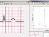 ECG paper image to Vector
