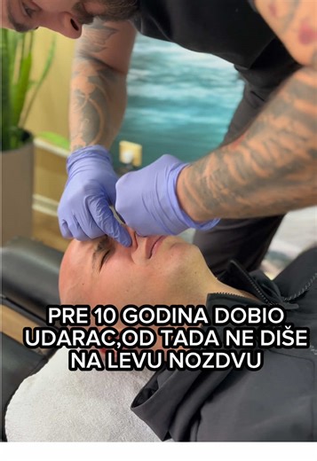 Deviated septum relief 🙏🏻 #devijacija👃 #septum #deviated #deviatedseptum #breath #disanje #zapusennos #nos #body #disanje #devijacija #zdravlje #balkan