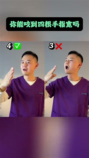 The Viral 4-Finger Jaw Challenge: Can You Bite As Wide As Four Fingers