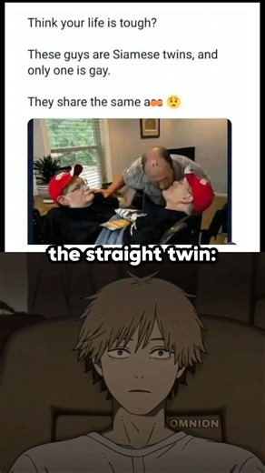 The genuine fear on bro's face 😞