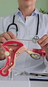 Medical Surgical Sterilization Tubal Ligation Doctor Stock Footage Video (100% Royalty-free) 3666220215 | Shutterstock