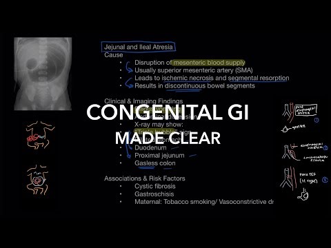 GI Embryology Explained: High-Yield Congenital GI Conditions