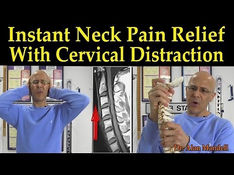 Instant Neck Pain Relief With Cervical Distraction Orthopedic Test (Self Diagnosis) - Dr Mandell