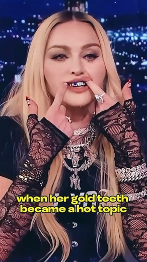 5 celebrities with the worst teeth 5 Celebrities With the Worst Teeth 😬🦷 Even fame and money can’t always buy a perfect smile! 😅✨ #CelebrityTeeth #HollywoodStars #CelebFacts #PopCulture #FamousPeople #BeforeAndAfter #CelebrityLooks #EntertainmentNews #CelebEdits #HollywoodLife #FamousFaces #CelebrityGossip | Celebrity Gossip999