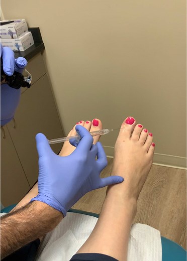 Ingrown Toenail Removal Process Explained