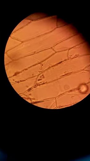 exemple d'une cellule végétale