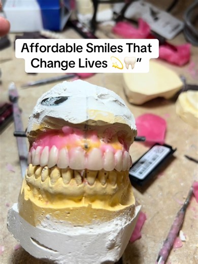 Affordable Smiles That Change Lives 💫🦷” There’s nothing more rewarding than seeing a real smile come back to life. Every denture I create is built with care, precision, and heart — because confidence starts with your smile. 💖 Whether it’s a full set, a repair, or a try-in, your new beginning starts here at Jo’s Denture Lab. 🦷✨#DentureTransformation #SmileMakeover #AffordableDentures #BeforeAndAfter #JOsDentureLab