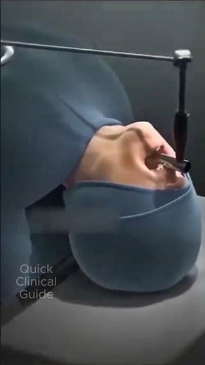 Vocal Cord Lesion Removal Surgery #anatomy #vocalcords