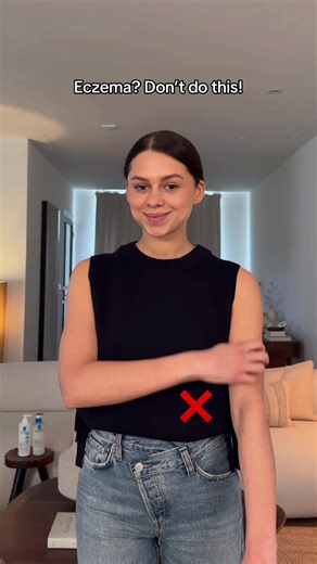 Easy Eczema Hack: Stop Scratching & Hydrate