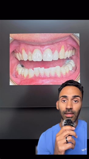 Hey Doc, if you’re seeing dozens of hygiene patients each week but not starting aligner cases… you’re leaving thousands on the table. Most practices miss it because they don’t have a simple system to identify and present the right cases. That’s what I’m breaking down in my free masterclass — the 3-step framework to turn hygiene into your number one source of aligner starts. If you want 3–5 aligner cases a month without adding extra chair time, click the link below and sign up for the Clear Align