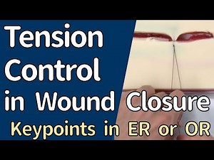 Knot Tying in Wound Closure - How to Adjust and Keep Suture Tension -