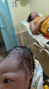 That swelling in the baby's head? That's caput succedaneum- common when labor takes a little bit longer. ❣️ | Rica Clomera