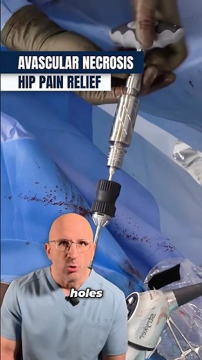 Drilling Away Hip Pain: Core Decompression #shorts