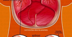 Asthme du chat : symptômes, traitement vétérinaire, espérance de vie - Catedog