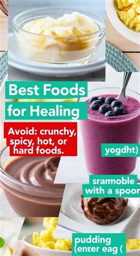 🦷 Getting Teeth Removed for Dentures — What to Expect