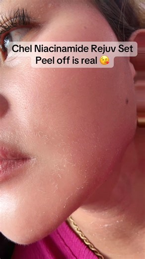 7.7K views · 64 reactions | Peel off is real  Chel Niacinamide rejuv set lang natin yan  | Chel Davao Bodega | Facebook
