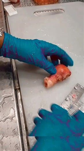 😎liquid❤. (मुसाफिर.❤️) on Instagram: "Uterus in anatomy hall 💀💀 #ᴅᴏɴᴛᴄᴏᴘʏʀɪɢʜᴛ⚠️ #anatomy"