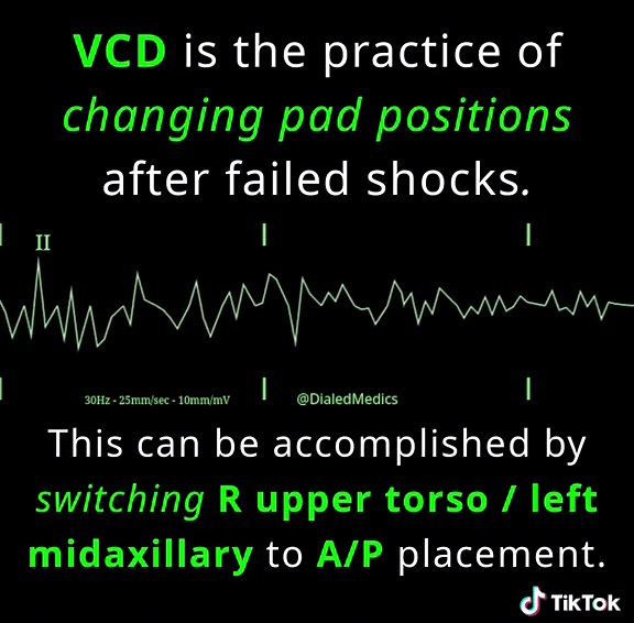 Vector Change Defibrillation in Ventricular Fibrillation Cardiac Arrest with ACLS Resuscitation