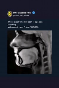Magnetic resonance imaging is a medical imaging technique used in radiology to form pictures of the anatomy and the physiological processes of the body. MRI scanners use strong magnetic fields, magnetic field gradients, and radio waves to generate images of the organs in the body. If you enjoyed this post, please give it a ❤️ and check out @facts_and_science for more science and daily facts. | Facts and Video | Facebook