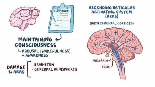 Video: Disorders of consciousness: Clinical - Video Explanation! | Osmosis | Osmosis