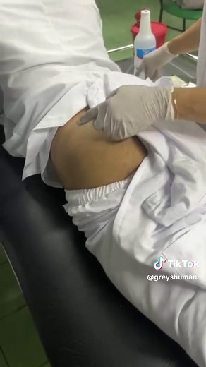 Inyección Glútea Segura: Evita Lesión Nervio Ciático