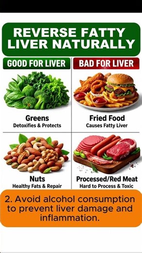 Reverse Fatty Liver with Foods!