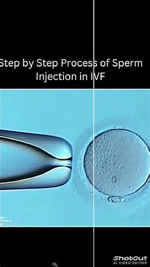 Step by step process of Sperm Injection in IVF🫨🫨🫨