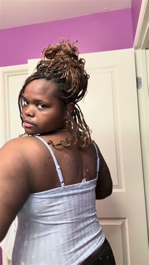 Back Lift by Dr. Deleon at prestige plastic surgery in Miami #backlift #breastreconstruction