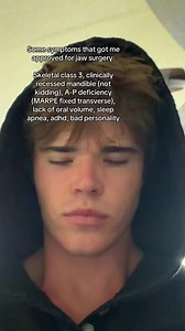 What are your symptoms? #bwython #djs #marpe #airwayorthodontics #lm | skeletal class 3