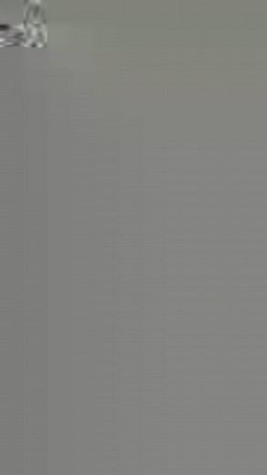 Importance of saving your teeth . If you extract one tooth and you don't do implant , bridge or denture, your total balance and harmony of teeth will be lost and your alignment will be damaged . #letscreatebeautifulsmile #drlailanoorenajnin #radiantsmiledentalclinic #letscreatemagic #white #tooth #prosthesis #bridging | Radiant Smile Dental Clinic