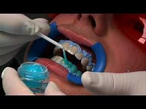 Pola Office Procedure Demonstration in Detail in English