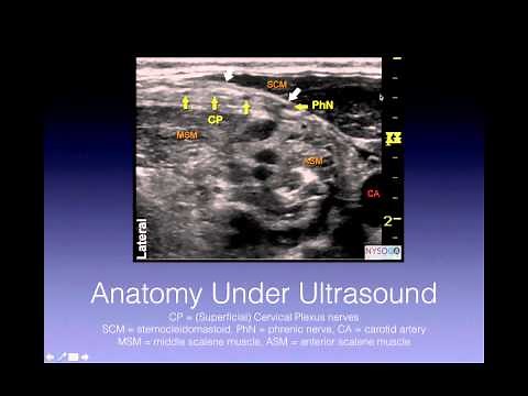 Tutorial: Superficial Cervical Plexus Block