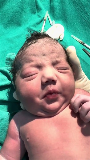 Healthy Newborn Baby 💖 | Just Born Baby Cute Movements | New Life Begins #nicubaby143