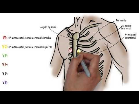 Como hacer un ECG electrocardiograma