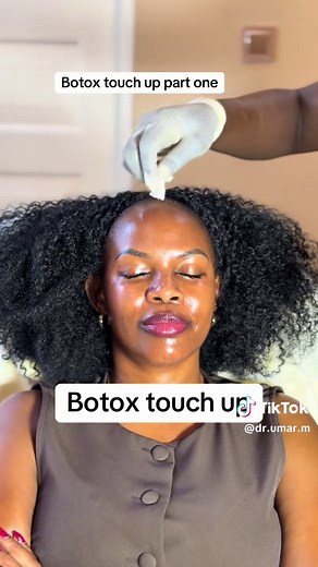 Understanding Botox: Benefits and Mechanisms