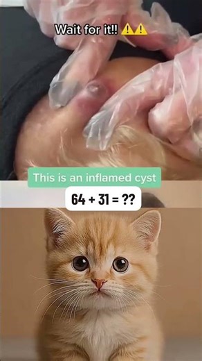 Removing large blackheads and pimples from face new 2026 #224